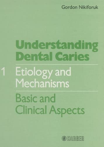 Understanding Dental Caries: Etiology and Mechanisms : Basic and Clinical Aspects