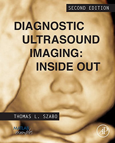 Diagnostic Ultrasound Imaging: Inside Out (Biomedical Engineering)