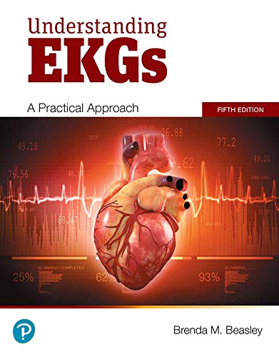 Understanding EKGs: A Practical Approach