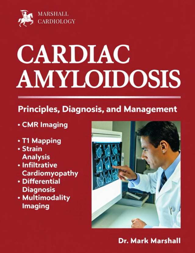 CARDIAC AMYLOIDOSIS: PRINCIPLES, DIAGNOSIS, AND MANAGEMENT