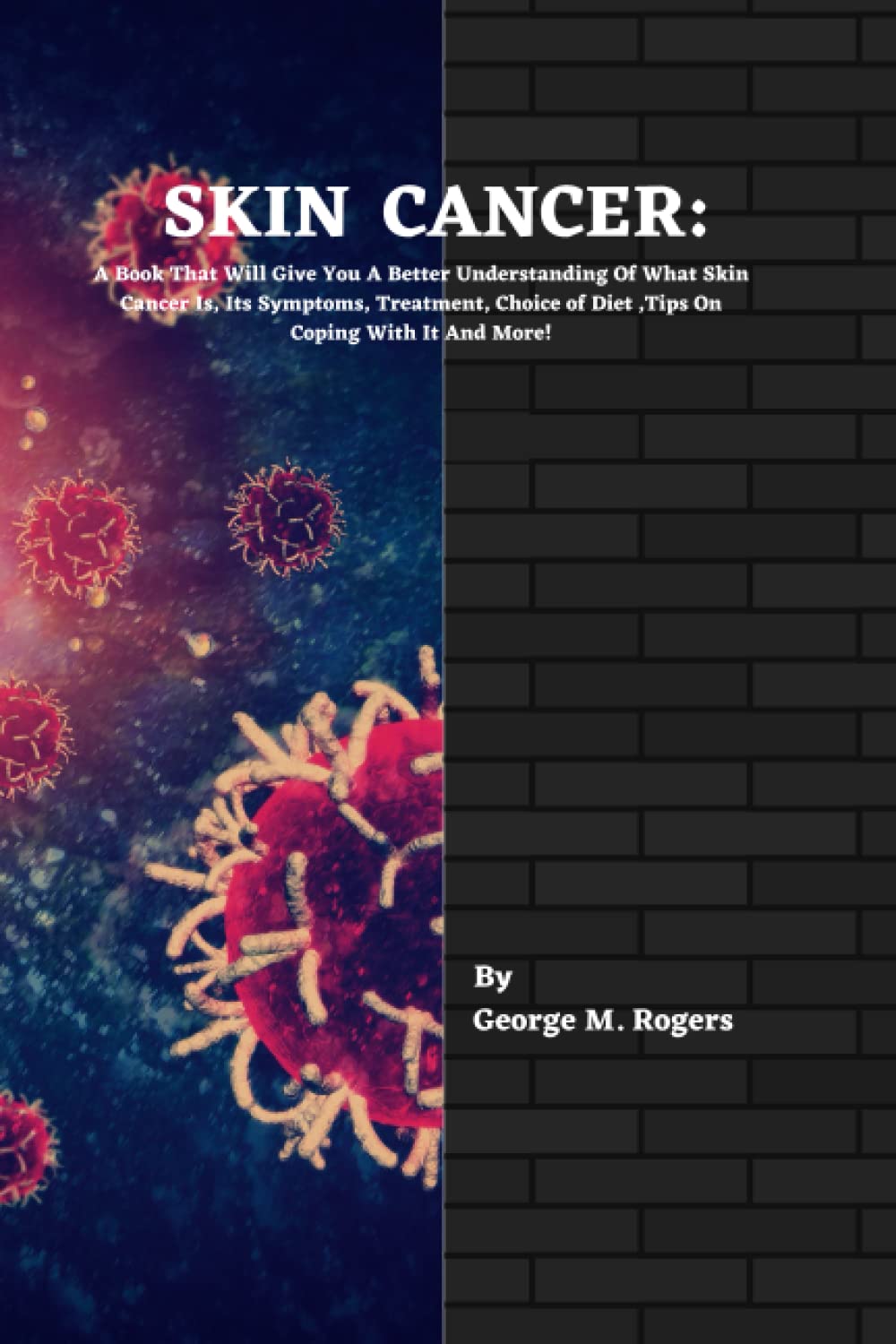 SKIN CANCER: A Book That Will Give You A Better Understanding Of What Skin Cancer Is, Its Symptoms, Treatment, Choice of Diet ,Tips On Coping With It And More! (Striving With Cancer)