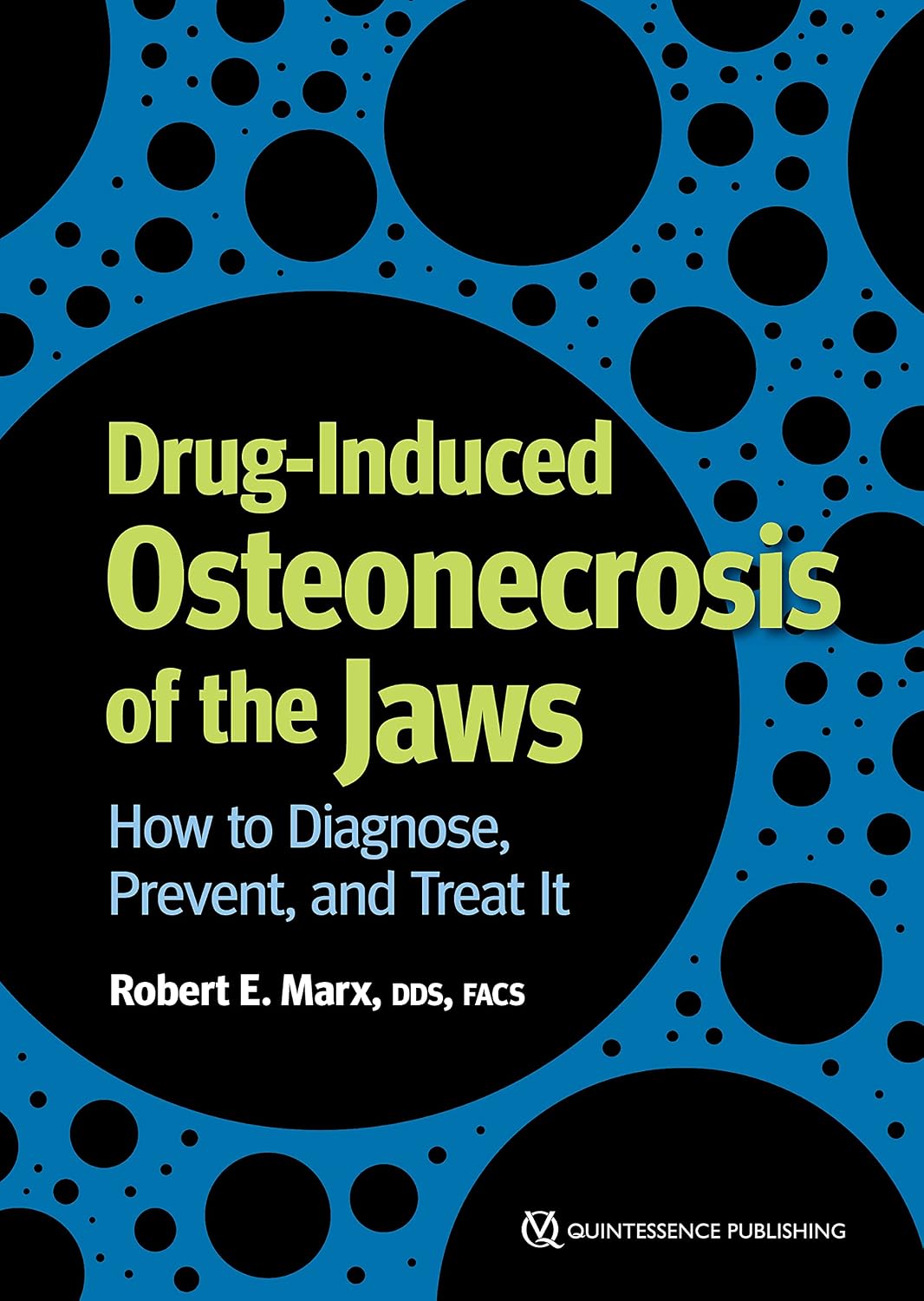 Drug-induced Osteonecrosis of the Jaws: How to Diagnose, Prevent, and Treat It
