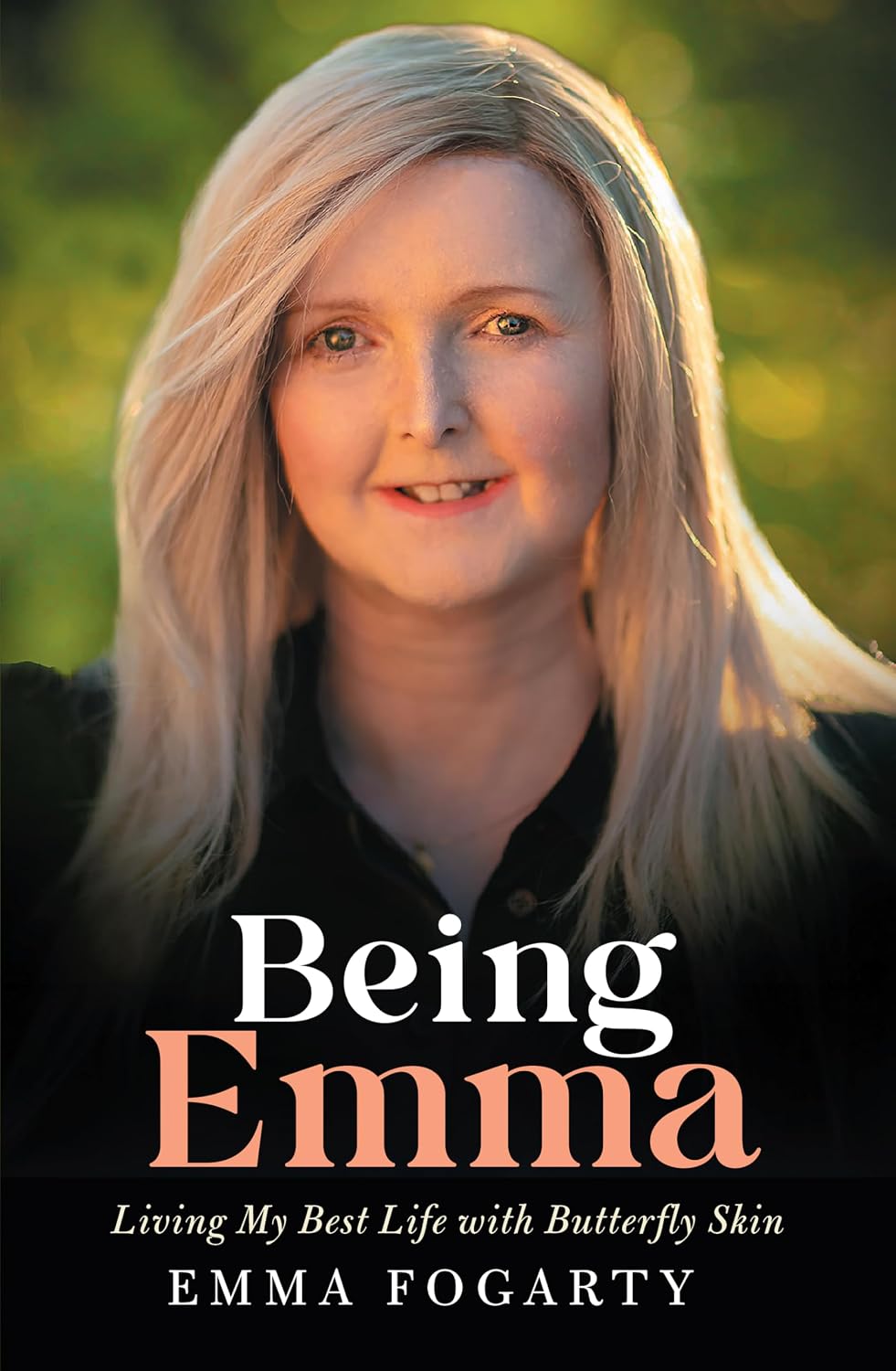 Being Emma: Living My Best Life with Butterfly Skin