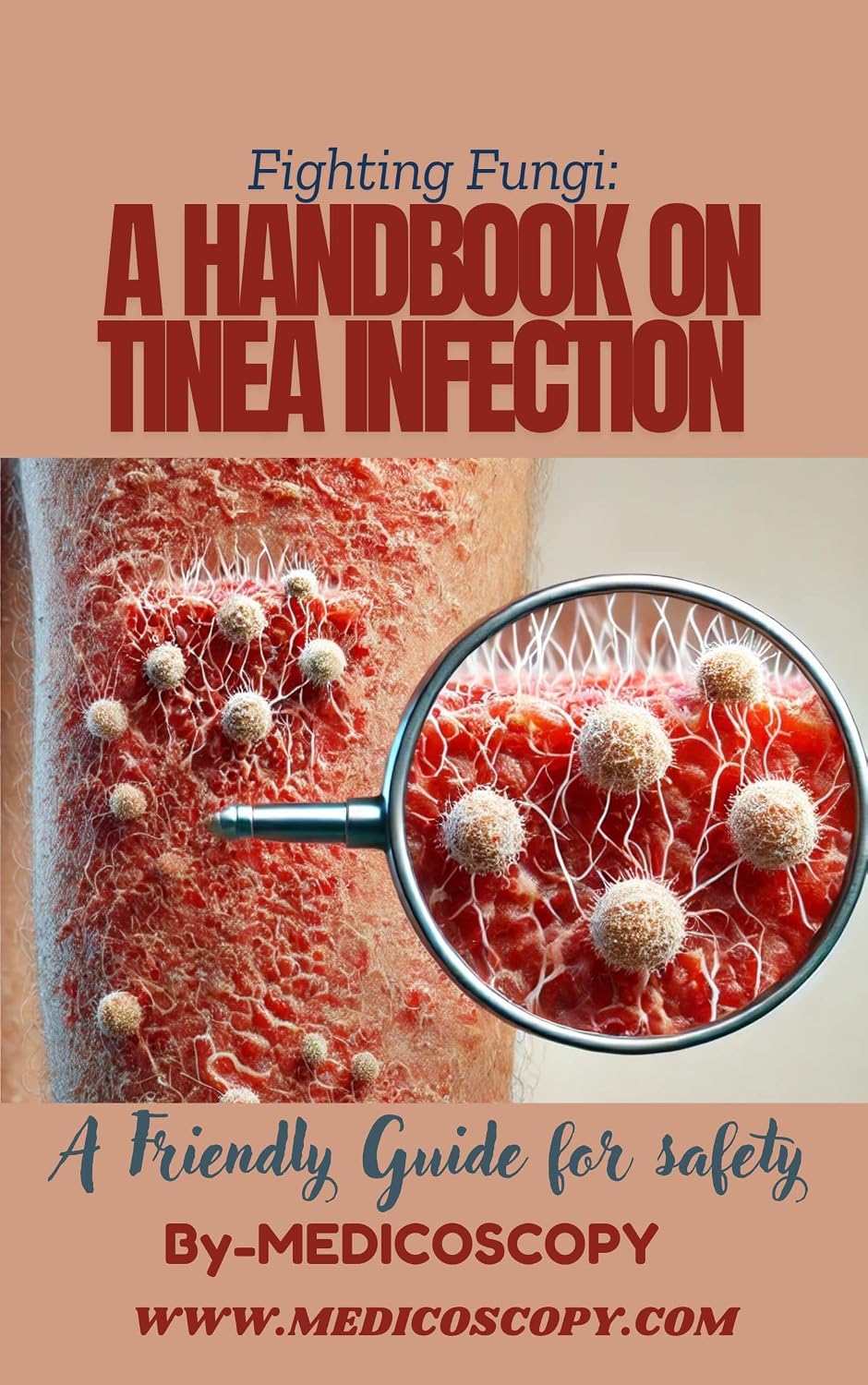 Fighting Fungi: A Handbook on Tinea Infection